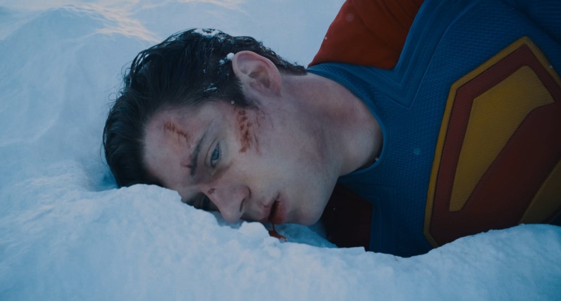 Superman lays beaten in the snow.